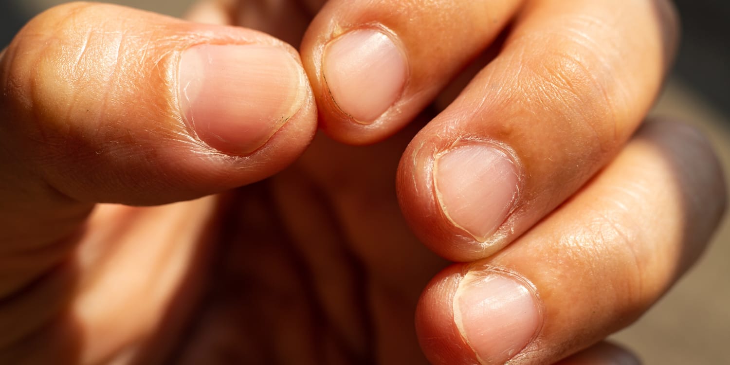 The Hidden Clues in Your Fingernails: A Simple Way to Spot Early Signs of Cancer