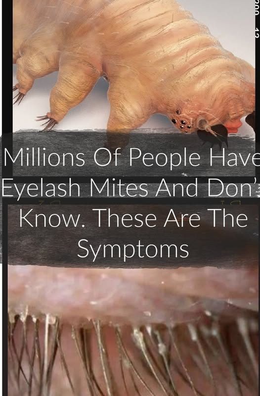 How to spot eyelash mites