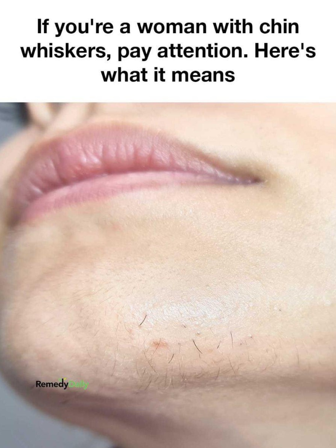 What Your Chin Hairs Might Be Revealing About Your Health